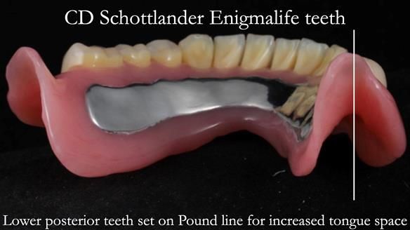Finlay's Newsletter 62 provision of extractions and metal based complete dentures for Rafique