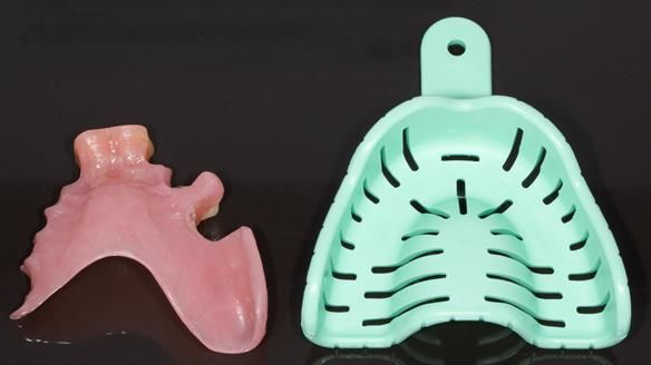 Newsletter 79 – Creating a wonderful smile and changing a life.