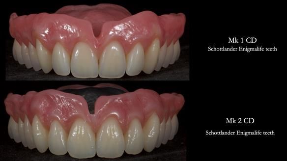 Newsletter 79 – Creating a wonderful smile and changing a life.