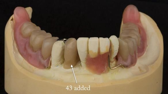 Ken – going downhill, first class