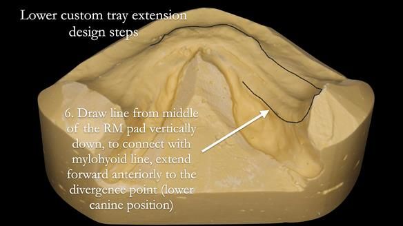 Newsletter 50 Special edition Complete Dentures FULL PROTOCOL