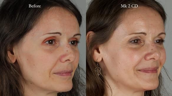 Newsletter 79 – Creating a wonderful smile and changing a life.