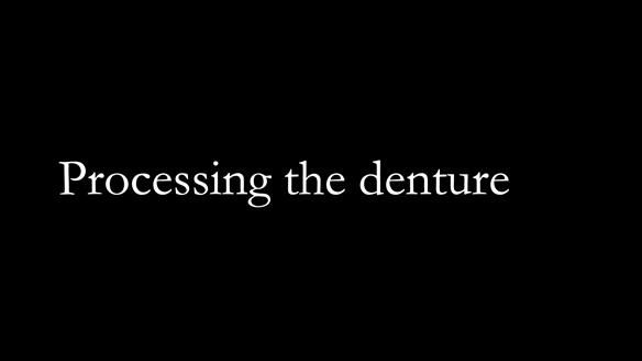 Newsletter 53 showing the making and fitting of ultra life-like dentures for Valena