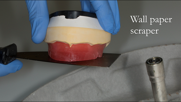 Figure 70 The incisal plane and occlusal plane are trimmed with a heated "wall paper" scraper