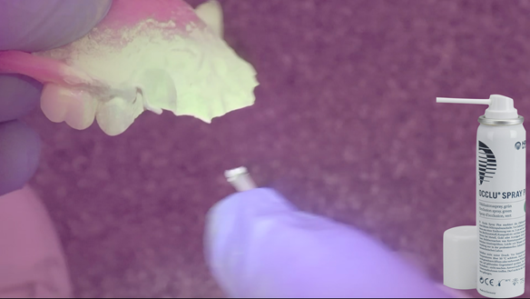 Figure 31 Occlude spray is used to check the fit of the collets