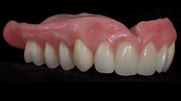 Newsletter 79 – Creating a wonderful smile and changing a life.