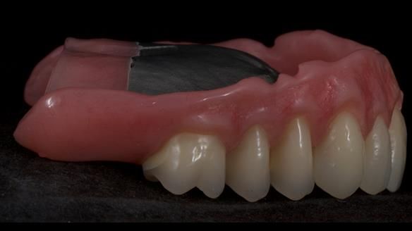 Newsletter 79 – Creating a wonderful smile and changing a life.