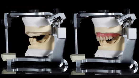 Newsletter 79 – Creating a wonderful smile and changing a life.