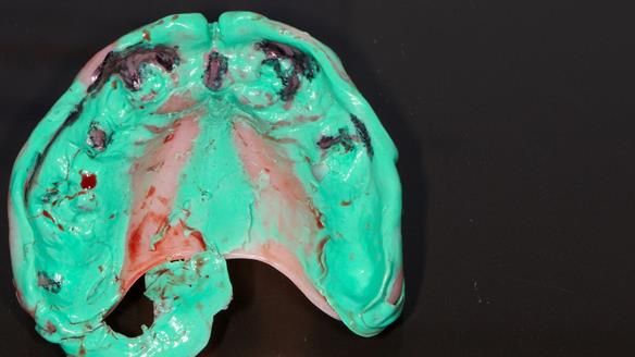 Newsletter 79 – Creating a wonderful smile and changing a life.