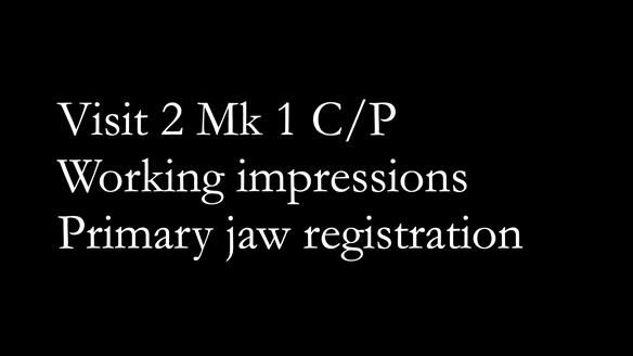 Newsletter 52 Managing Jo’s failing dentition with extractions and Mk 1/Mk 2 complete upper dentures and lower partial dentures FULL PROTOCOL