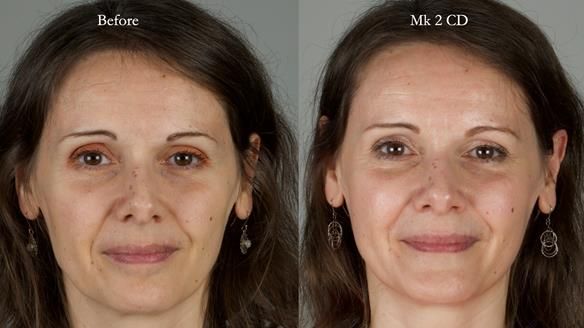 Newsletter 79 – Creating a wonderful smile and changing a life.