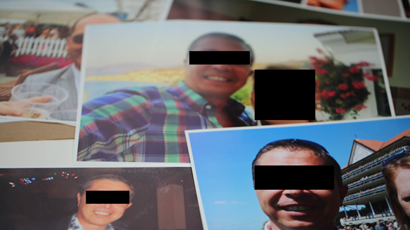 Figure 21 Photos of the patients natural dentition he wanted mimicking