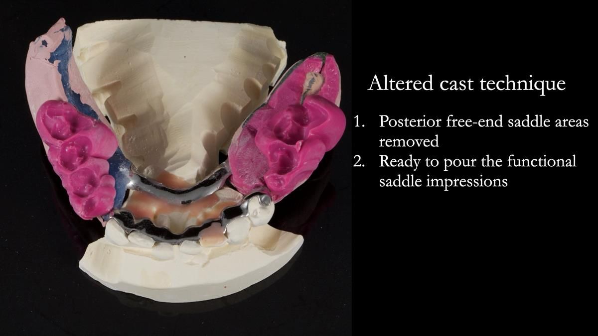 Newsletter 87 – Father Peter: A Partial Denture that needed Minor Miracle