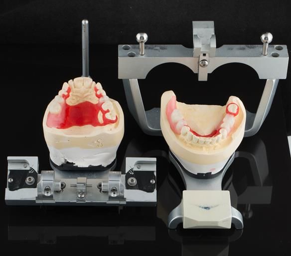 Figure 61 Teeth try in on pattern resin bases. These help to confirm the accuracy of the working casts and the amount of metal work which will be visible in the final dentures