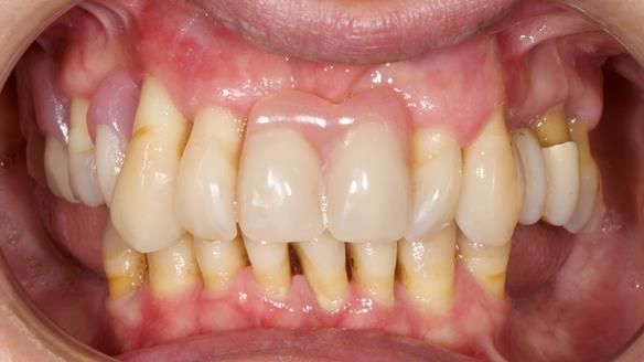 Newsletter 79 – Creating a wonderful smile and changing a life.