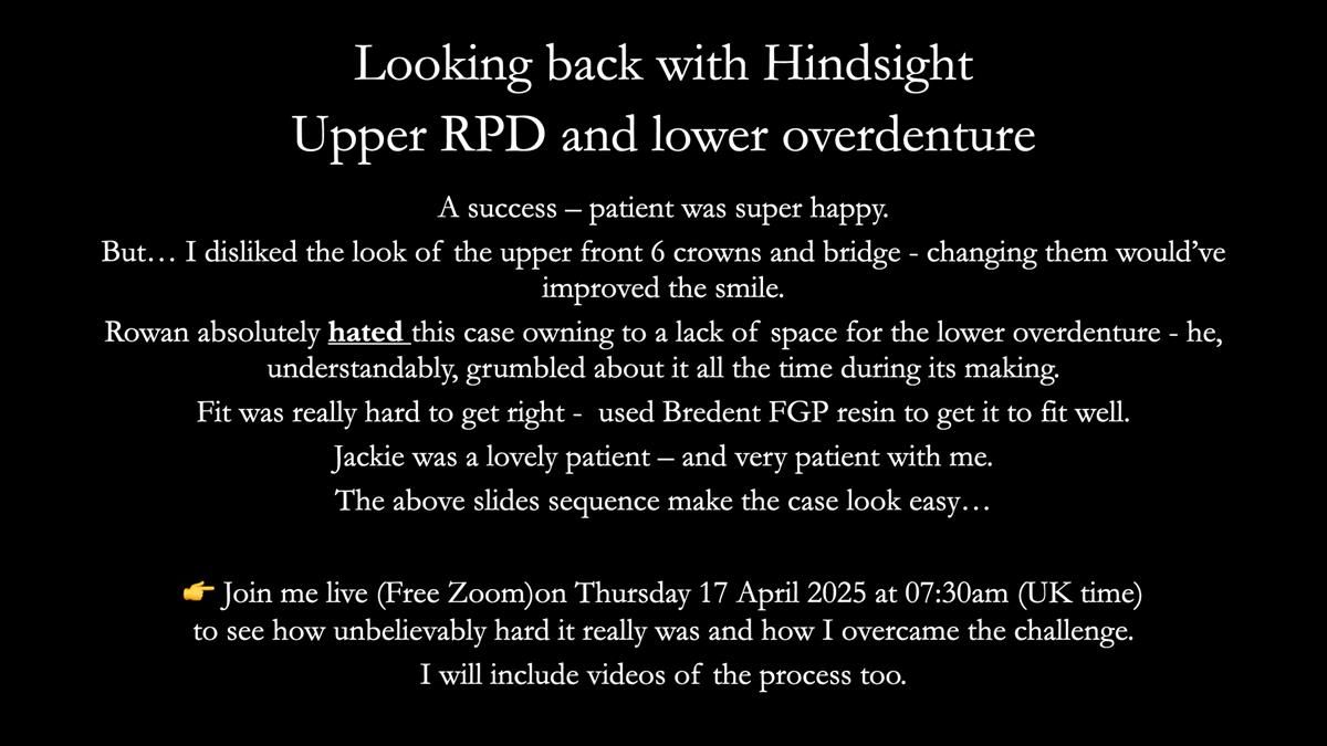 Newsletter 76: Jackie’s case – Telescopic overdenture & precision RPD (the tricky truth!)