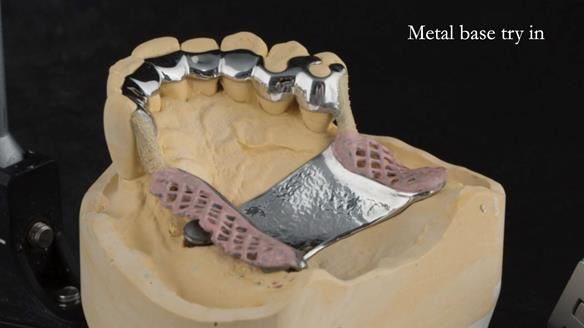 Ken – going downhill, first class