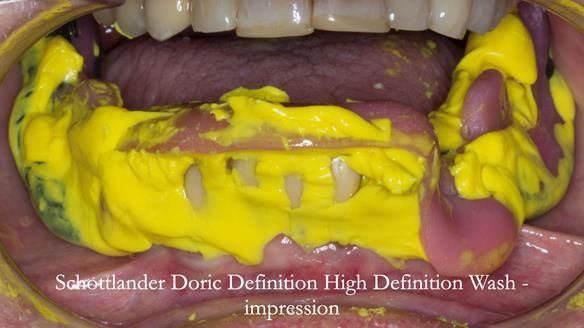 Ken – going downhill, first class