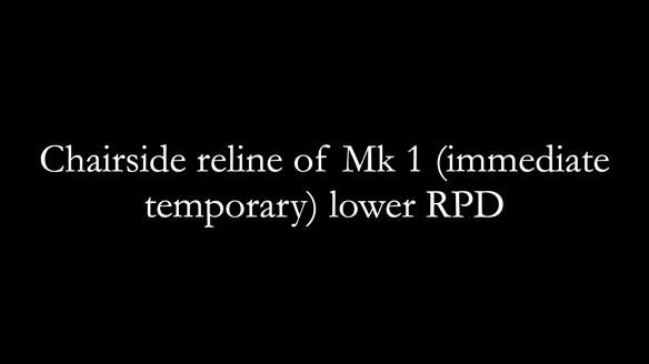 Newsletter 82 Mary - A complete upper and a one-tooth gasket denture