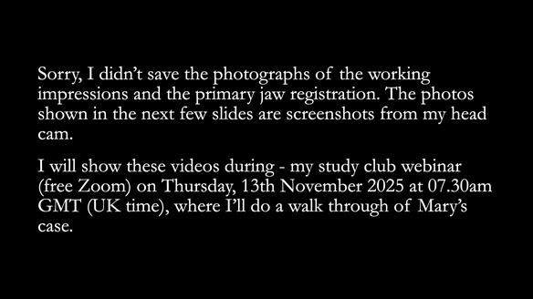 Newsletter 82 Mary - A complete upper and a one-tooth gasket denture