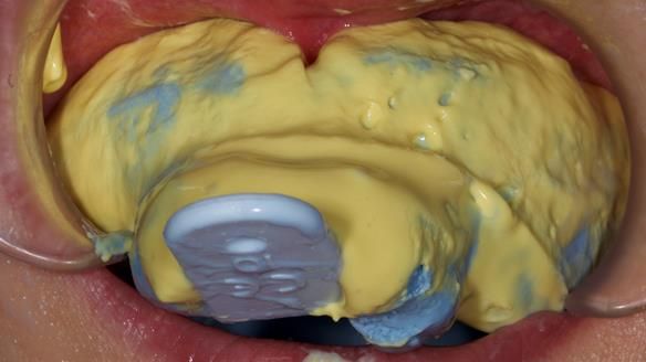 Newsletter 79 – Creating a wonderful smile and changing a life.