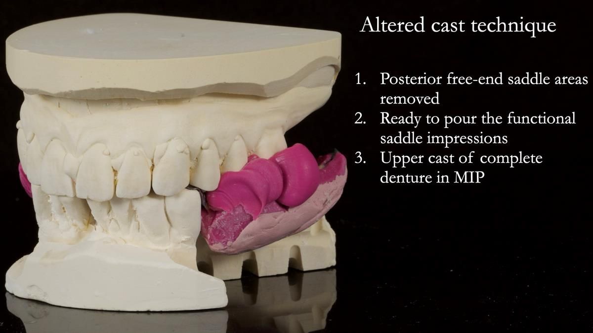 Newsletter 87 – Father Peter: A Partial Denture that needed Minor Miracle