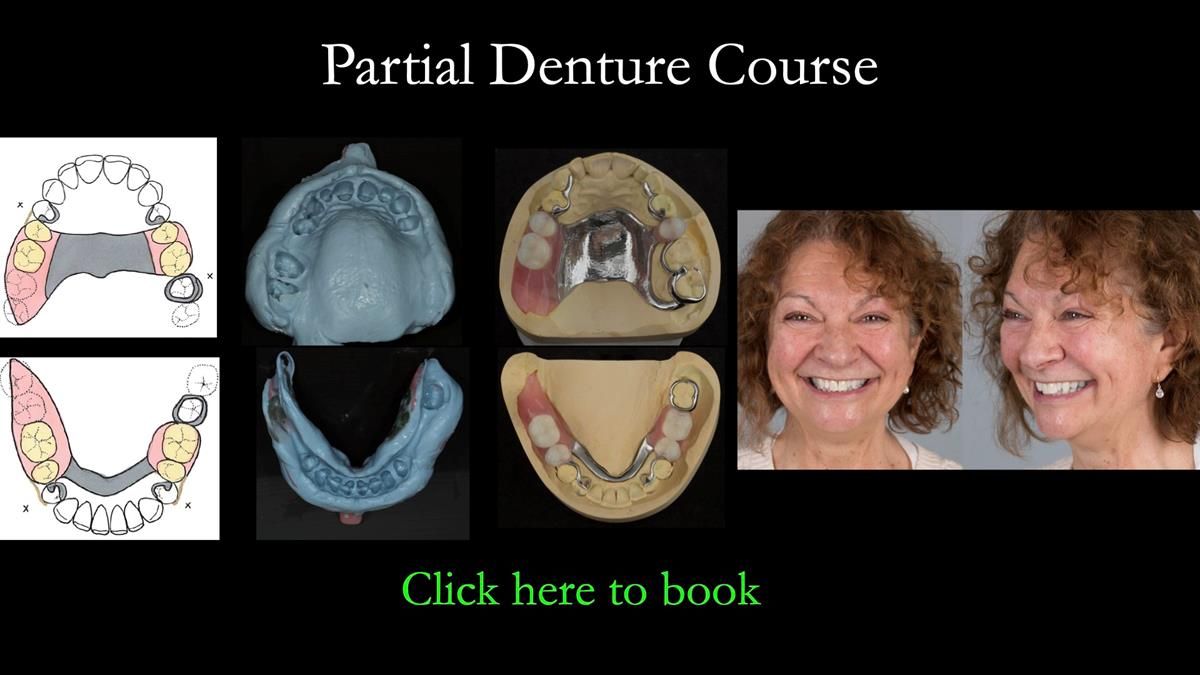 Newsletter 87 – Father Peter: A Partial Denture that needed Minor Miracle
