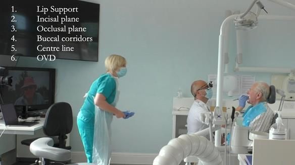 Complete denture Class II div 2 deep overbite Newsletter 39