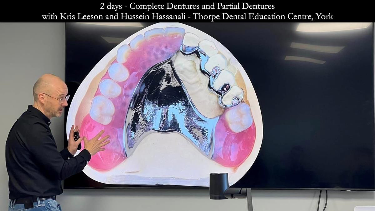 Finlay's Newsletter 59 Ultra hard partial dentures made for Gill