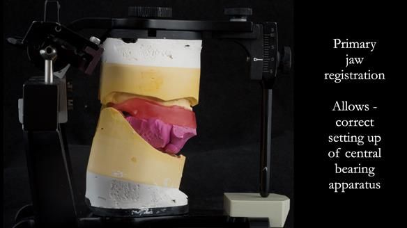 Primary jaw registration - used to mount the work casts to allow correct setting up of the central bearing apparatus - gothic arch tracing system