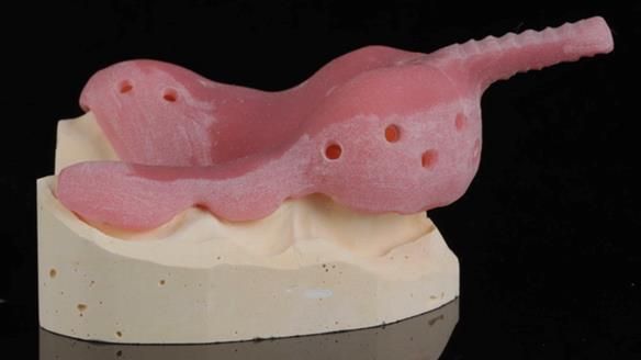 Finlay's Newsletter 60 Sylvia's upper Kennedy Class 2 Mod 1 metal based upper RPD