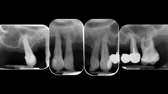 Newsletter 79 – Creating a wonderful smile and changing a life.