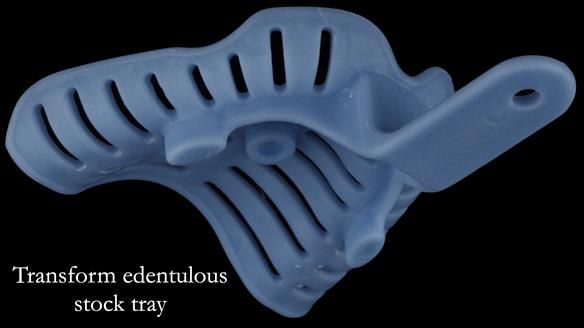 Newsletter 80 - Gordon’s dentures: the one case in 1,000 where my technique failed