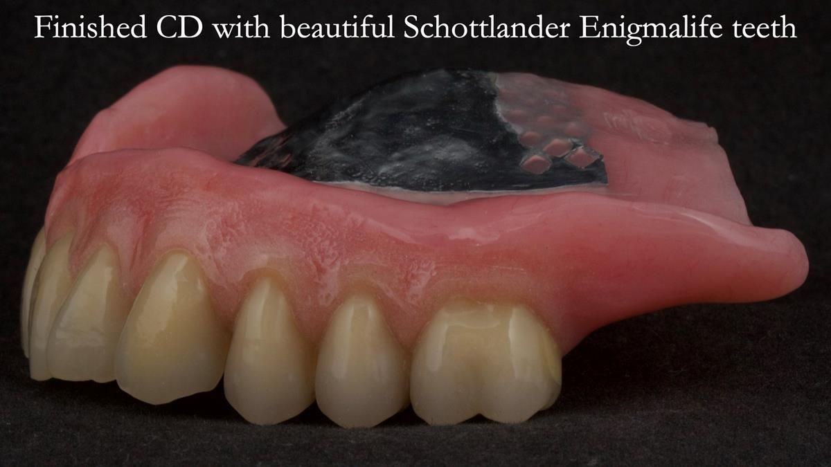 Newsletter 87 – Father Peter: A Partial Denture that needed Minor Miracle