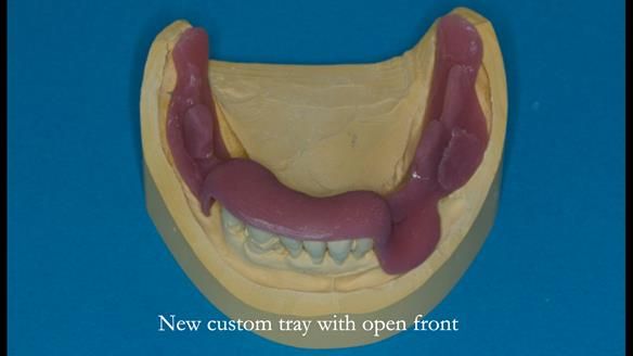 Ken – going downhill, first class