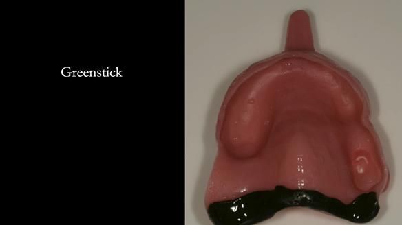 Ken – going downhill, first class