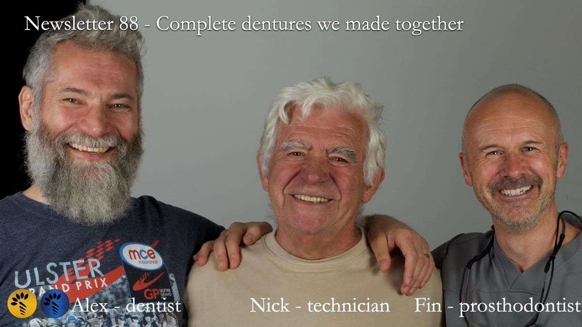 Fin’s Newsletter 88 — Complete dentures - full protocol… he rearranged his own teeth!