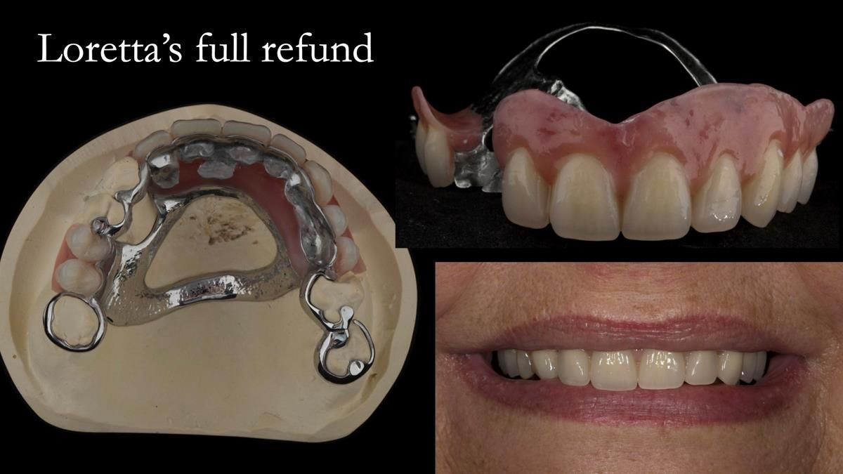 Newsletter 87 – Father Peter: A Partial Denture that needed Minor Miracle