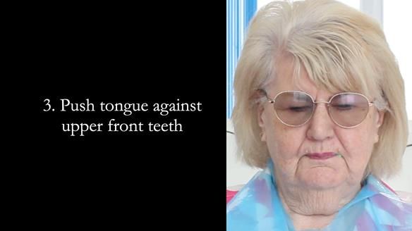 Replacing Madeline’s Complete denture FULL PROTOCOL