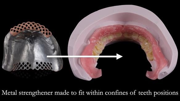Newsletter 50 Special edition Complete Dentures FULL PROTOCOL