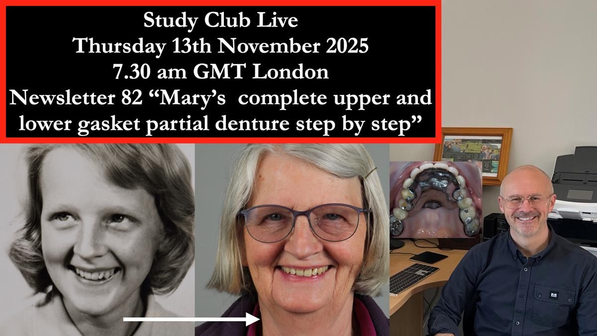 Newsletter 82 Mary - A complete upper and a one-tooth gasket denture