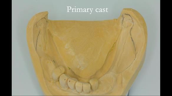 Ken – going downhill, first class