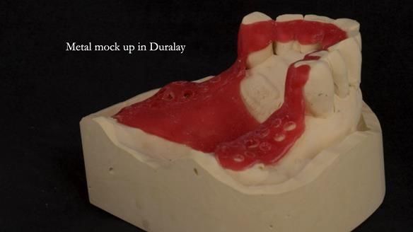 Ken – going downhill, first class