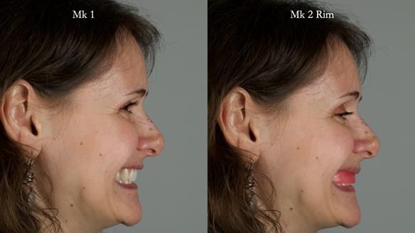 Newsletter 79 – Creating a wonderful smile and changing a life.