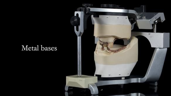 Newsletter 55 Provision of metal based partial dentures for Zephyrine with a repaired cleft lip and palate