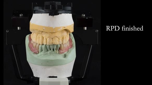 Ken – going downhill, first class