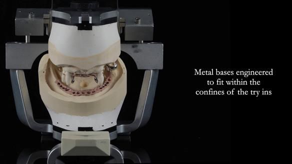 Finlay's Newsletter 59 Ultra hard partial dentures made for Gill