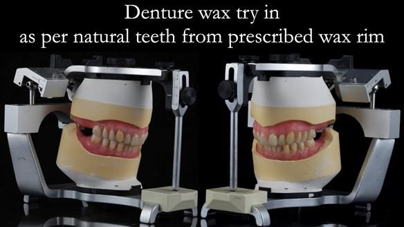 Newsletter 50 Special edition Complete Dentures FULL PROTOCOL