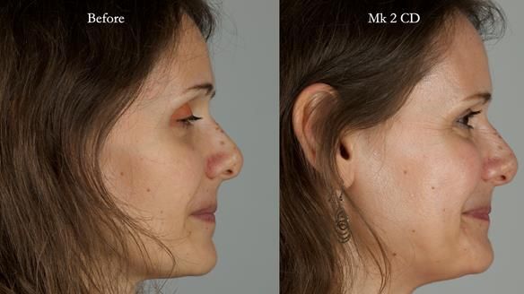 Newsletter 79 – Creating a wonderful smile and changing a life.