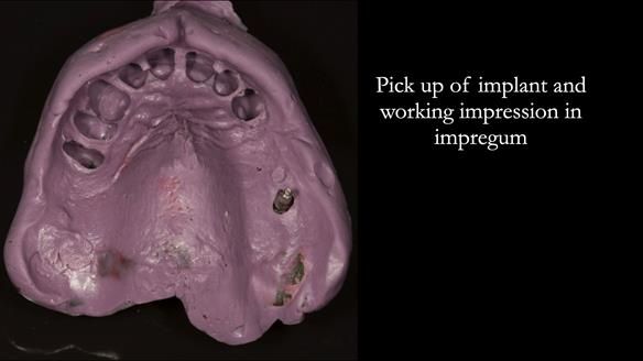 Ken – going downhill, first class